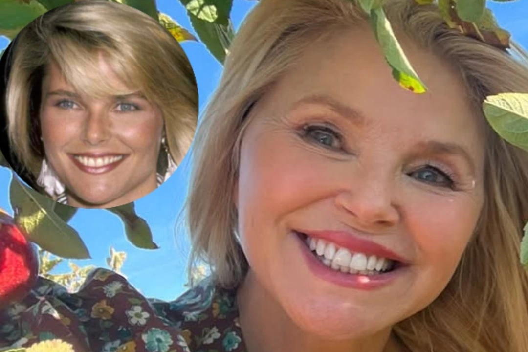 Christie Brinkley teeth implant before after