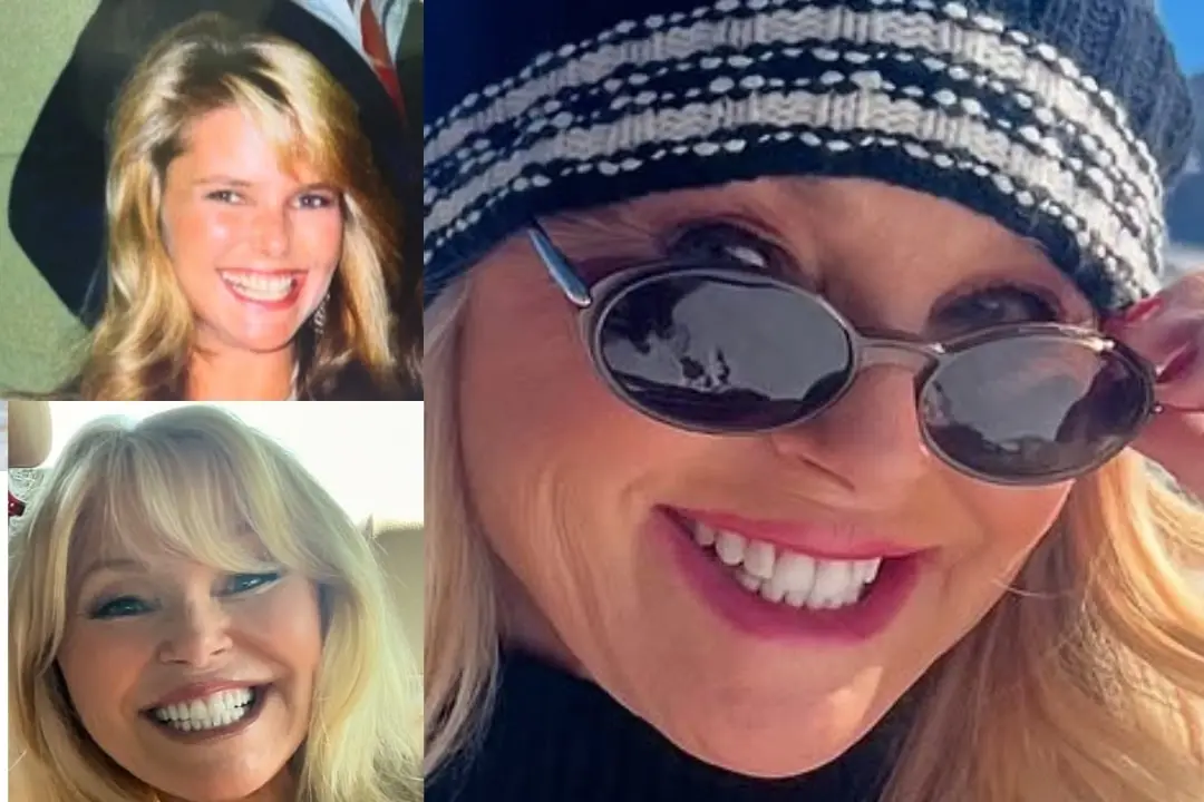 Christie Brinkley dental implant