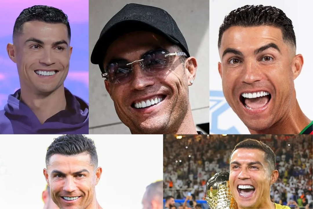 Cristiano Ronaldo dental implant 