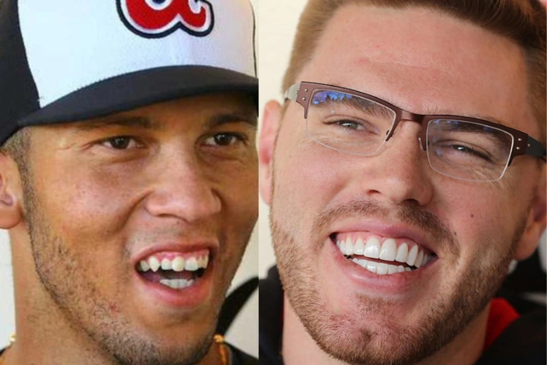 Freddie Freeman dental implant