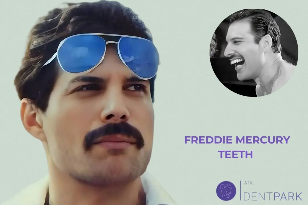 Freddie Mercury's Teeth: What You Need to Know | Atk Dentpark