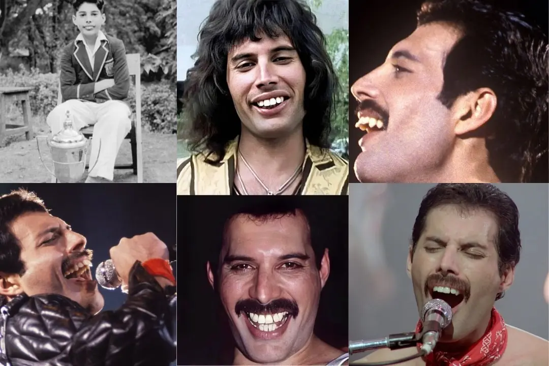 What was wrong with Freddie Mercury's teeth?