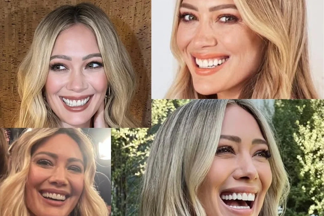 Hilary Duff teeth implant
